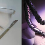 Evolution Of Oropharyngeal Cancer Surgery