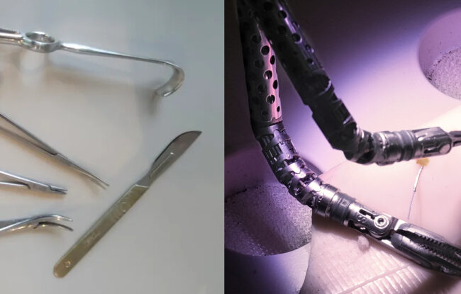 Evolution Of Oropharyngeal Cancer Surgery